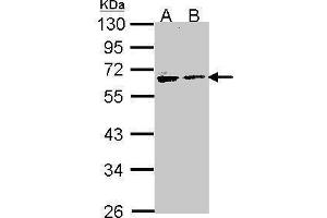 WB Image Sample (30 ug of whole cell lysate) A: H1299 B: Hela 10% SDS PAGE antibody diluted at 1:1000 (Arylsulfatase A 抗体)