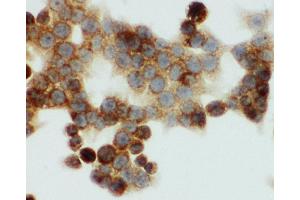 Immunohistochemistry (IHC) image for anti-One Cut Homeobox 1 (ONECUT1) (AA 187-203), (N-Term) antibody (ABIN3044467)