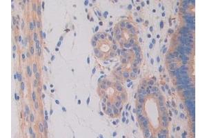 Detection of HEXb in Mouse Uterus Tissue using Polyclonal Antibody to Hexosaminidase B Beta (HEXb)