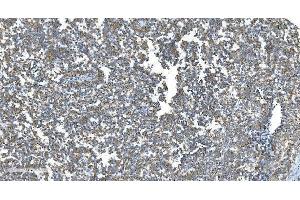 IHC analysis of DRP1/DNM1L using anti-DRP1/DNM1L antibody (ABIN7602180). (Dynamin 1-Like 抗体  (AA 618-736))