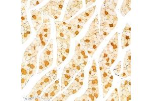 Immunohistochemistry analysis of paraffin-embedded rat muscle using,MYH7 (ABIN7075623) at dilution of 1: 1000