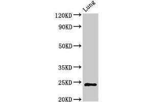 Western Blot Positive WB detected in: Rat lung tissue All lanes: CHMP6 antibody at 3 μg/mL Secondary Goat polyclonal to rabbit IgG at 1/50000 dilution Predicted band size: 24 kDa Observed band size: 24 kDa (CHMP6 抗体  (AA 2-201))