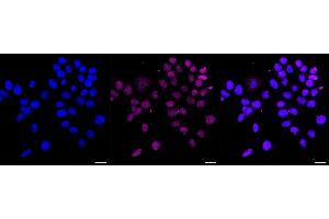 Immunocytochemical staining of HAP-1 cells with NK2 homeobox 2 antibody (ABIN7799610), 1:1,000). (Recombinant Nkx2-2 抗体)
