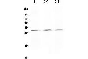 Anti-Kallikrein 2 antibody, Western blottingAll lanes: Anti Kallikrein 2  at 0. (Kallikrein 2 抗体  (C-Term))