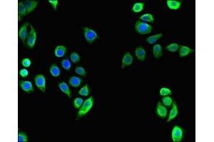 Immunofluorescent analysis of PC-3 cells using ABIN7171684 at dilution of 1:100 and Alexa Fluor 488-congugated AffiniPure Goat Anti-Rabbit IgG(H+L) (TECPR2 抗体  (AA 516-783))