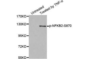 Western blot analysis of extract from MDA-MB-435 cells, using Phospho-NFKB2-S870 antibody. (NFKB2 抗体  (pSer870))