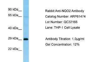 Western Blotting (WB) image for anti-NQO2 (NQO2) (C-Term) antibody (ABIN2788817) (NQO2 抗体  (C-Term))