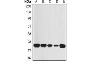 Western blot analysis of KNP-I expression in SW480 (A), HepG2 (B), mouse skin (C), mouse heart (D), rat skeletal muscle (E) whole cell lysates. (KNP-1 抗体)