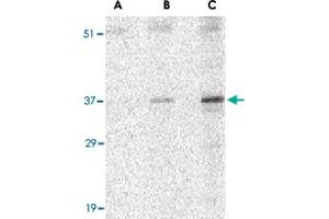 Western blot analysis of UNG in C2C12 cell lysate with UNG polyclonal antibody  at (A) 0. (UNG 抗体  (N-Term))