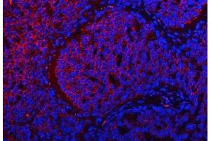 IF analysis of TRMT2B using anti-TRMT2B antibody (ABIN7599456).