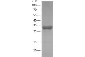 Western Blotting (WB) image for 3-phosphoinositide Dependent Protein Kinase-1 (PDPK1) (AA 92-151) protein (His-IF2DI Tag) (ABIN7121616) (PDPK1 Protein (AA 92-151) (His-IF2DI Tag))