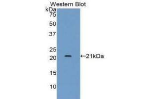 Western blot analysis of the recombinant protein. (LIFR 抗体  (AA 522-691))