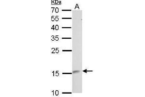 WB Image LMO1 antibody detects LMO1 protein by Western blot analysis. (LMO1 抗体)