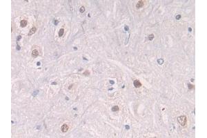 Detection of CTSG in Rat Spinal cord Tissue using Polyclonal Antibody to Cathepsin G (CTSG) (Cathepsin G 抗体  (AA 51-250))