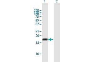 Western Blot analysis of CYP2U1 expression in transfected 293T cell line by CYP2U1 MaxPab polyclonal antibody. (CYP2U1 抗体  (AA 1-168))