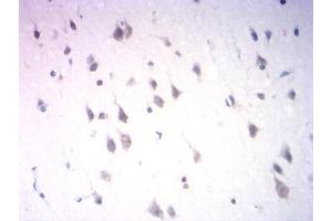 Immunohistochemical analysis of paraffin-embedded human brain tissues using Neurod mouse mAb with DAB staining.