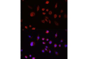 Immunohistochemistry of paraffin-embedded rat lung using  Rabbit pAb (ABIN6133551, ABIN6136733, ABIN6136738 and ABIN6215039) at dilution of 1:150 (40x lens). (AKT1 抗体  (C-Term))