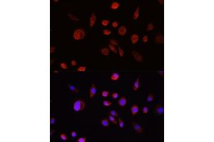 Immunohistochemistry of paraffin-embedded rat lung using  Rabbit pAb (ABIN6133551, ABIN6136733, ABIN6136738 and ABIN6215039) at dilution of 1:150 (40x lens). (AKT1 抗体  (C-Term))