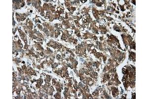 Immunohistochemical staining of paraffin-embedded pancreas tissue using anti-PIM2 mouse monoclonal antibody. (TPMT 抗体)