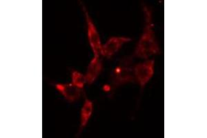 ABIN6274589 staining Hela cells by IF/ICC. (ARRDC3 抗体  (C-Term))