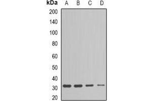 Western blot analysis of ESD expression in Jurkat (A), HepG2 (B), mouse liver (C), mouse kidney (D) whole cell lysates. (Esterase D 抗体)