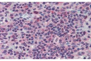 Detection of LAG3 in Human Spleen Tissue using Polyclonal Antibody to Lymphocyte Activation Gene 3 (LAG3) (LAG3 抗体  (AA 209-451))