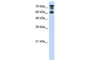 WB Suggested Anti-PPP1R13L Antibody Titration:  0. (PPP1R13L 抗体  (C-Term))