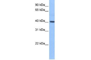 WB Suggested Anti-PDXK Antibody Titration: 0. (PDXK 抗体  (Middle Region))