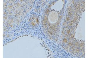 ABIN6276407 at 1/100 staining Human uterus tissue by IHC-P. (Angiopoietin 2 抗体  (N-Term))