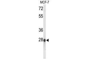 Western blot analysis of ABHDB Antibody (Center) in MCF-7 cell line lysates (35 µg/lane).