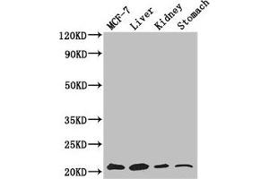 Western Blot Positive WB detected in: MCF-7 whole cell lysate, Mouse liver tissue, Mouse kidney tissue, Mouse stomach tissue All lanes: GNPNAT1 antibody at 3. (GNPNAT1 抗体  (AA 1-184))