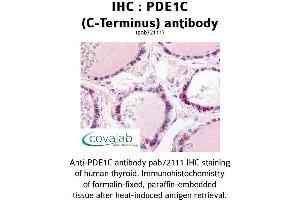 Image no. 1 for anti-phosphodiesterase 1C, Calmodulin-Dependent 70kDa (PDE1C) (C-Term) antibody (ABIN1737910) (PDE1C 抗体  (C-Term))