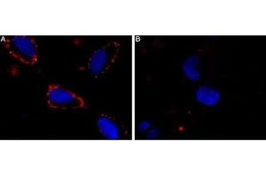 Immunocytochemistry (ICC) image for anti-Sodium Channel, Voltage-Gated, Type III, alpha Subunit (SCN3A) (AA 277-288), (Extracellular) antibody (ABIN7043644)