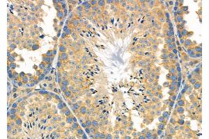 ABIN6264077 and ABIN6278944 at 1/100 staining Mouse testis tissue by IHC-P. (PDCD2L 抗体  (Internal Region))