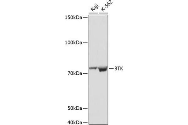 BTK 抗体