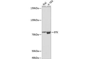 Western blot analysis of extracts of various cell lines, using BTK antibody (ABIN7265950) at 1:1000 dilution. (BTK 抗体)