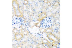 Immunohistochemistry of paraffin-embedded mouse kidney using CEACAM7 antibody at dilution of 1:100 (40x lens). (CEACAM7 抗体)