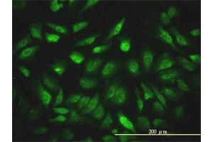 Immunofluorescence of monoclonal antibody to NCOA4 on HeLa cell. (NCOA4 抗体  (AA 1-575))