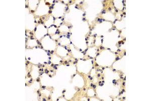 Immunohistochemistry of paraffin-embedded mouse lung using CBX5 antibody at dilution of 1:100 (400x lens).