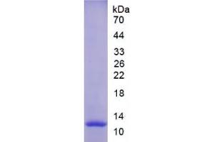 SDS-PAGE analysis of Rat MMP12 Protein. (MMP12 蛋白)