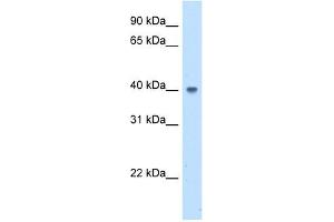ABHD5 antibody used at 5 ug/ml to detect target protein. (ABHD5 抗体  (N-Term))