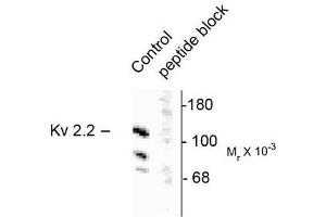 Image no. 1 for anti-Potassium Voltage-Gated Channel, Shab-Related Subfamily, Member 2 (KCNB2) antibody (ABIN372705) (Kv2.2 抗体)