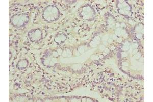 Immunohistochemistry of paraffin-embedded human small intestine tissue using ABIN7162860 at dilution of 1:100 (PPIL3 抗体  (AA 2-161))