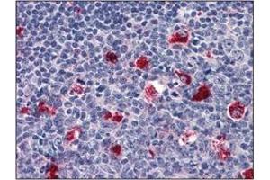 Immunohistochemistry (IHC) image for anti-Cathepsin D (CTSD) (AA 21-412) antibody (ABIN317502) (Cathepsin D 抗体  (AA 21-412))