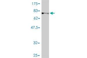 Western Blot detection against Immunogen (78. (NEK11 抗体  (AA 1-482))