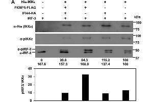 Western Blotting (WB) image for anti-Inhibitor of kappa Light Polypeptide Gene Enhancer in B-Cells, Kinase epsilon (IKBKE) (pThr501) antibody (ABIN100676)
