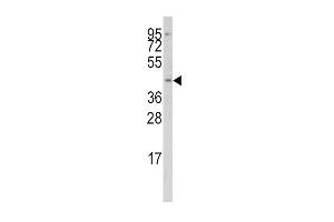 Western blot analysis of anti-IRF8 Antibody (Center) (ABIN389337 and ABIN2839449) in Jurkat cell line lysates (35 μg/lane). (IRF8 抗体  (AA 241-269))