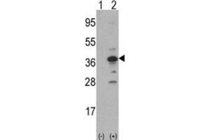 Western Blotting (WB) image for anti-DNA Segment, MCA1, Multiple CA Repeat 1 (MCA1) antibody (ABIN3002773) (MCA1 抗体)