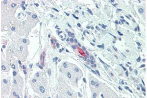 Anti-SLC5A1 / SGLT1 antibody  ABIN1049342 IHC staining of human liver. (SLC5A1 抗体  (Internal Region))
