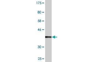 Western Blot detection against Immunogen (37. (SCYL3 抗体  (AA 553-660))
